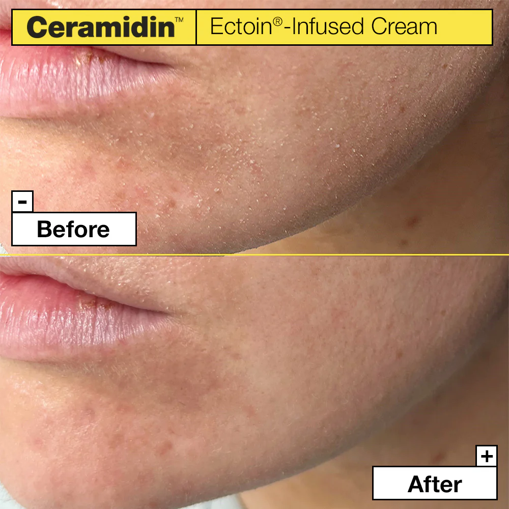 Ceramidin™ krema s ektoinom - hidratantna dnevna krema