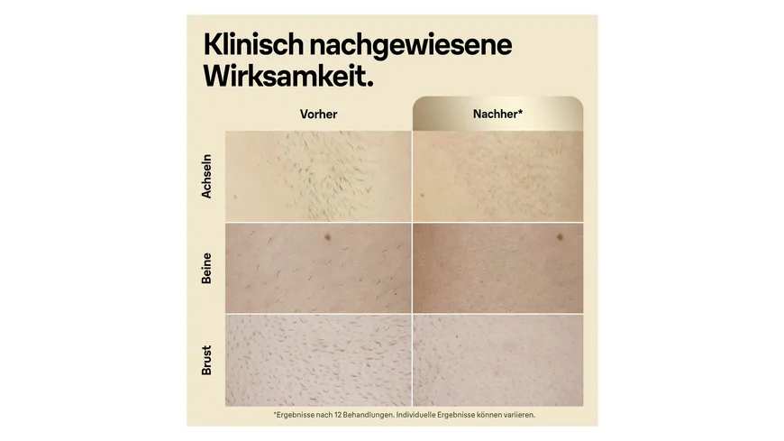 BRAUN IPL-Haarentfernungsgerät Silk·expert Pro 5 PL5152 Weiß / Gold