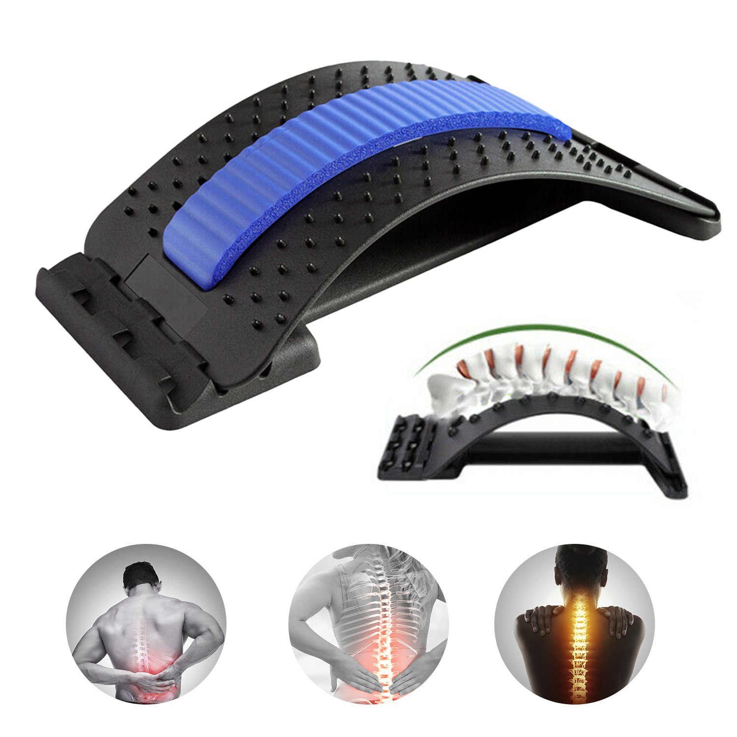 Lospitch Rückentrainer Rückenstrecker Massagegerät Rückenmassage Rückentrainer Lordosenstütze, (1-tlg), Einstellbar/Bogenstützende Design