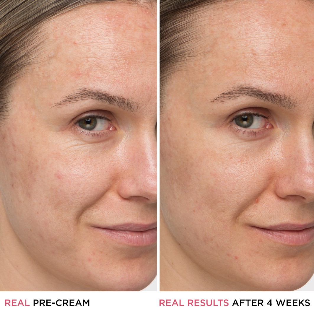 Confidence in a Cream Supercharged Anti-Aging Creme
