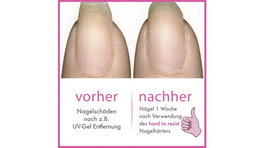 ESSIE Nagelhärter HARD TO RESIST PINK 13.5 ml