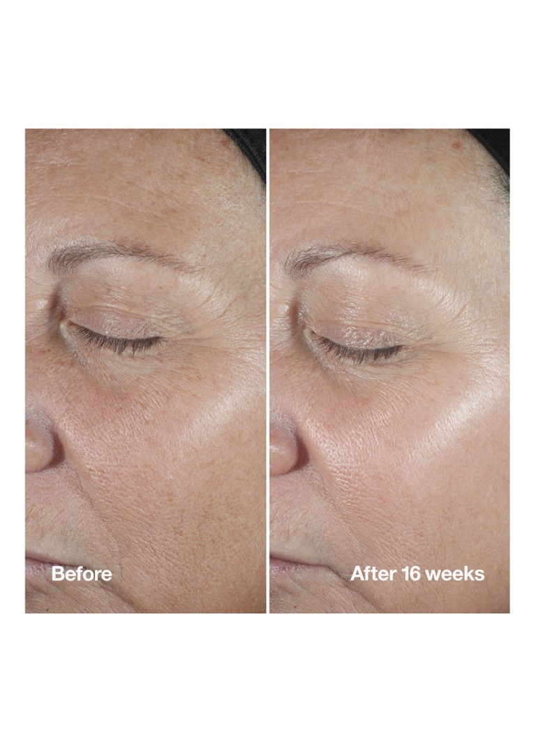 Siero antirughe Clinique Smart Clinical Repair™