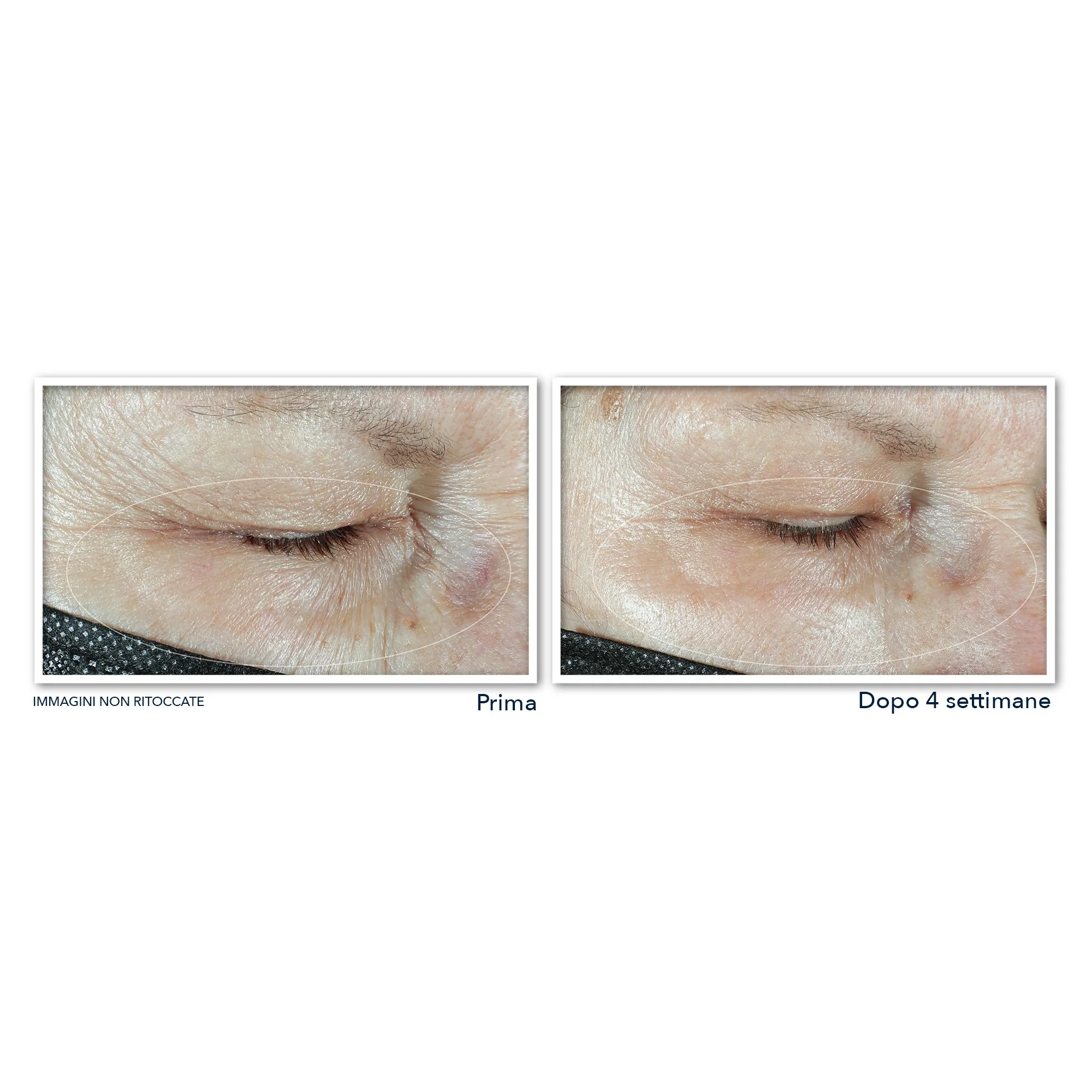 Crema contorno de ojos Multi Correxion Hydrate + Plump - Contorno de ojos antiarrugas, contorno de ojos hidratante
