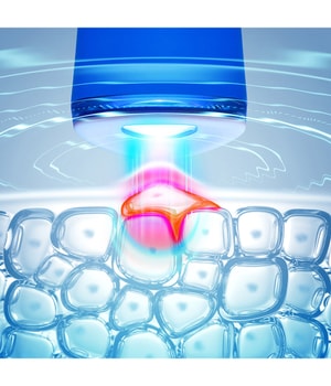 FOREO ESPADA™ 2 Cobalt Blue Gesichtspeeling-1 Stk