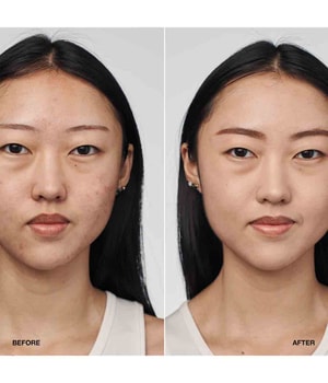 CLINIQUE Even Better Clinical Serum SPF20 Flüssige Foundation-30 ml