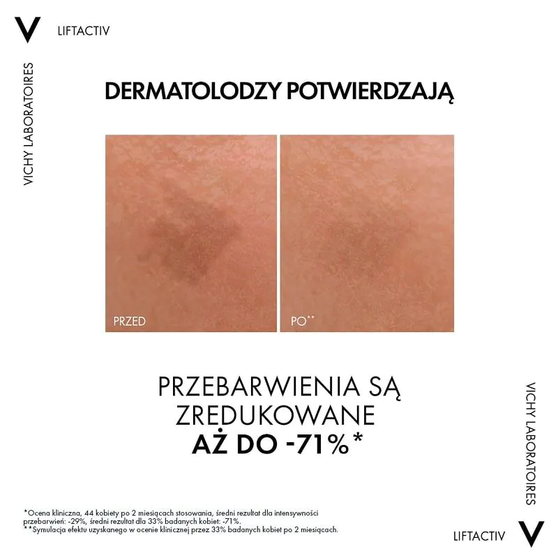 „Vichy Liftactiv Specialist B3“ serumas odos dėmėms ir raukšlėms mažinti su 5 % niacinamido.