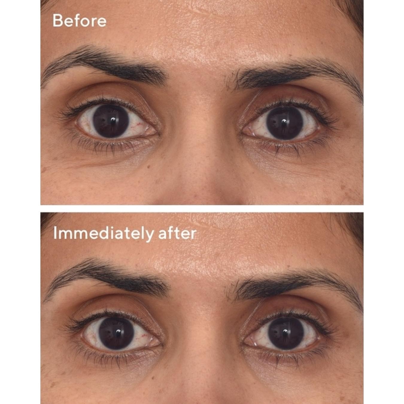 RSG Retinol Youth Renewal Eye Masks - 5 pack