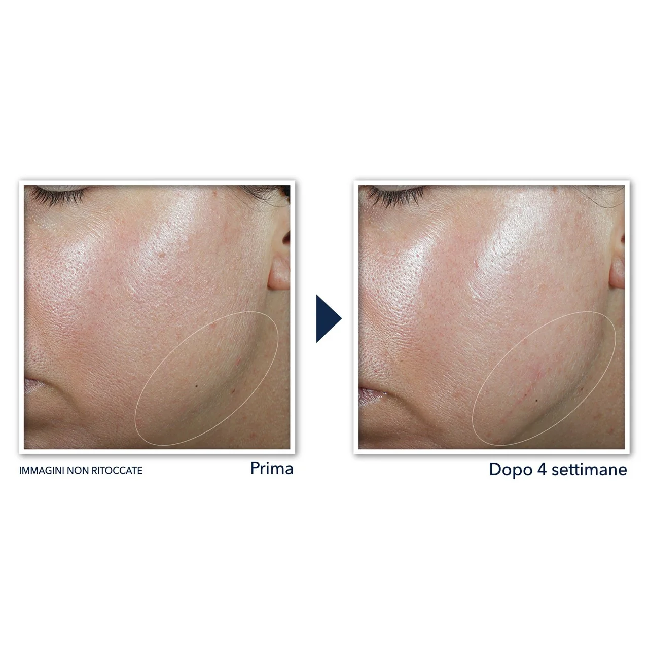 Crème visage Derm Correxion - Soin anti-rides 24h, soin anti-imperfections 24h, soin effet global 24h