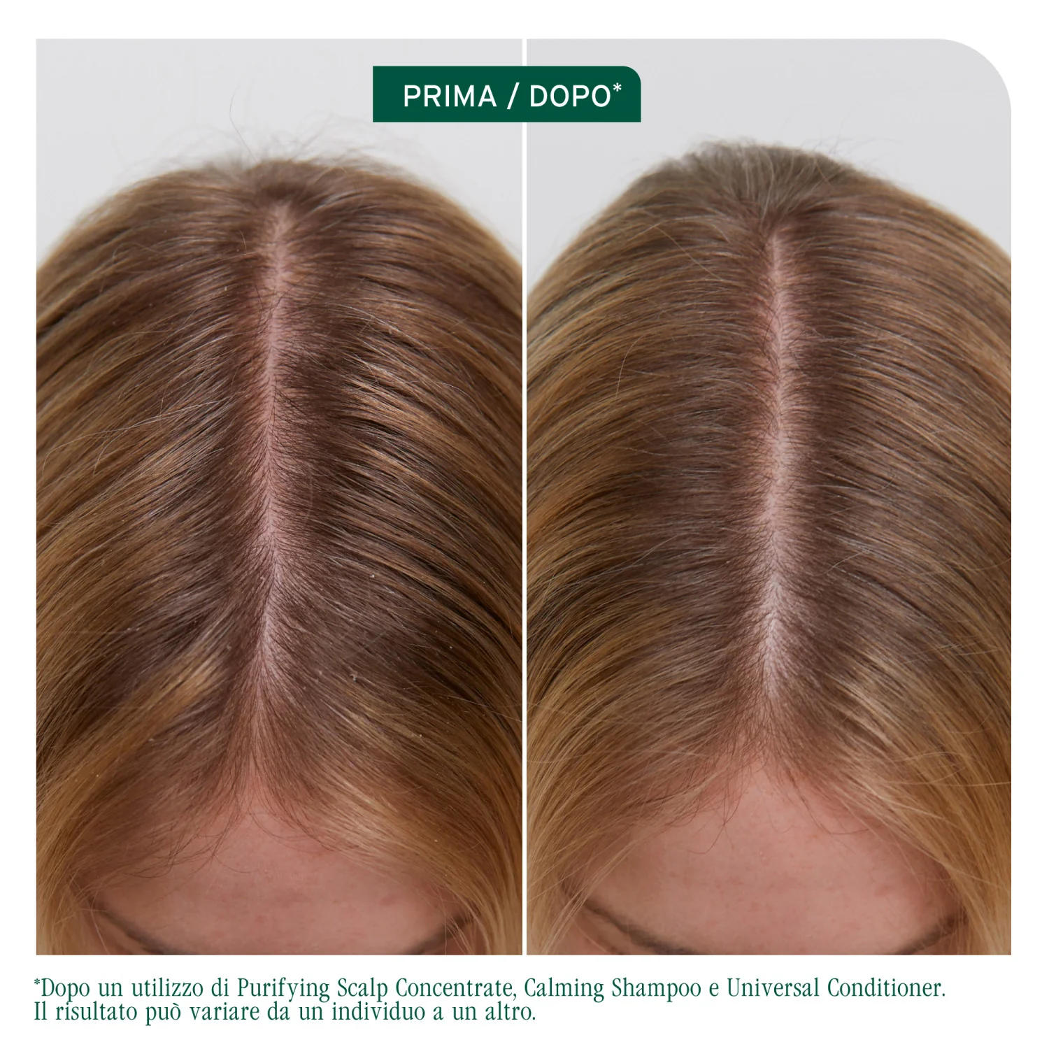 Scalp Sync pročišćavajući šampon - šampon za pročišćavanje