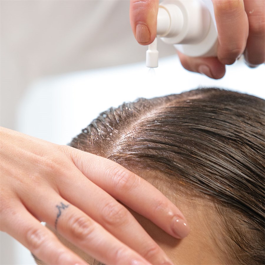 Scalp Moisturizing Lotion