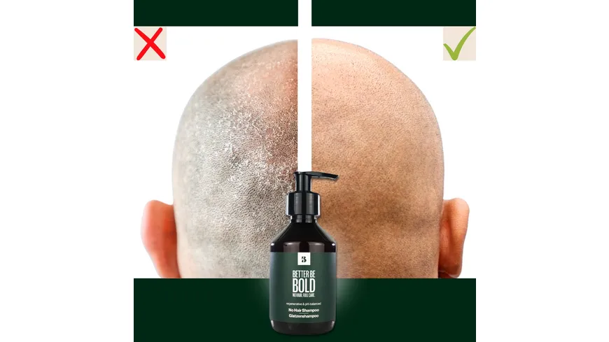 BETTER BE BOLD Pflegendes Glatzenshampoo (0-6mm) 200 ml