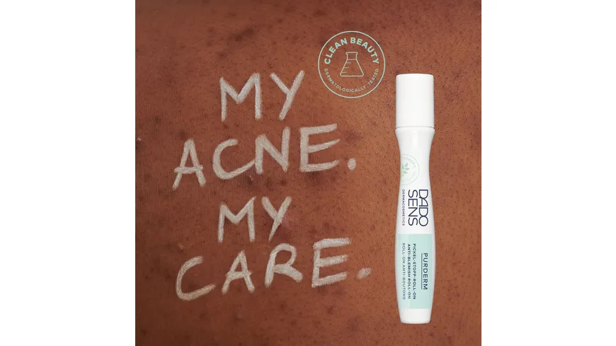 DADO SENS PURDERM Pickel-Stopp Roll-On  - bei unreiner Haut 10 ml