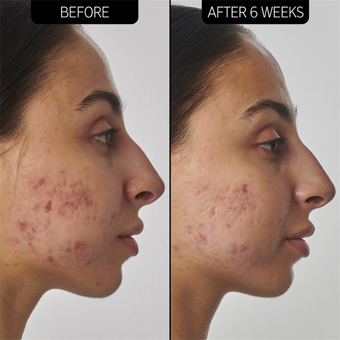 SuperSolutions 1% Retinol Serum