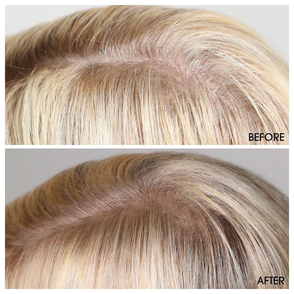 M2 Beauté Hair Activating Serum 120 ml