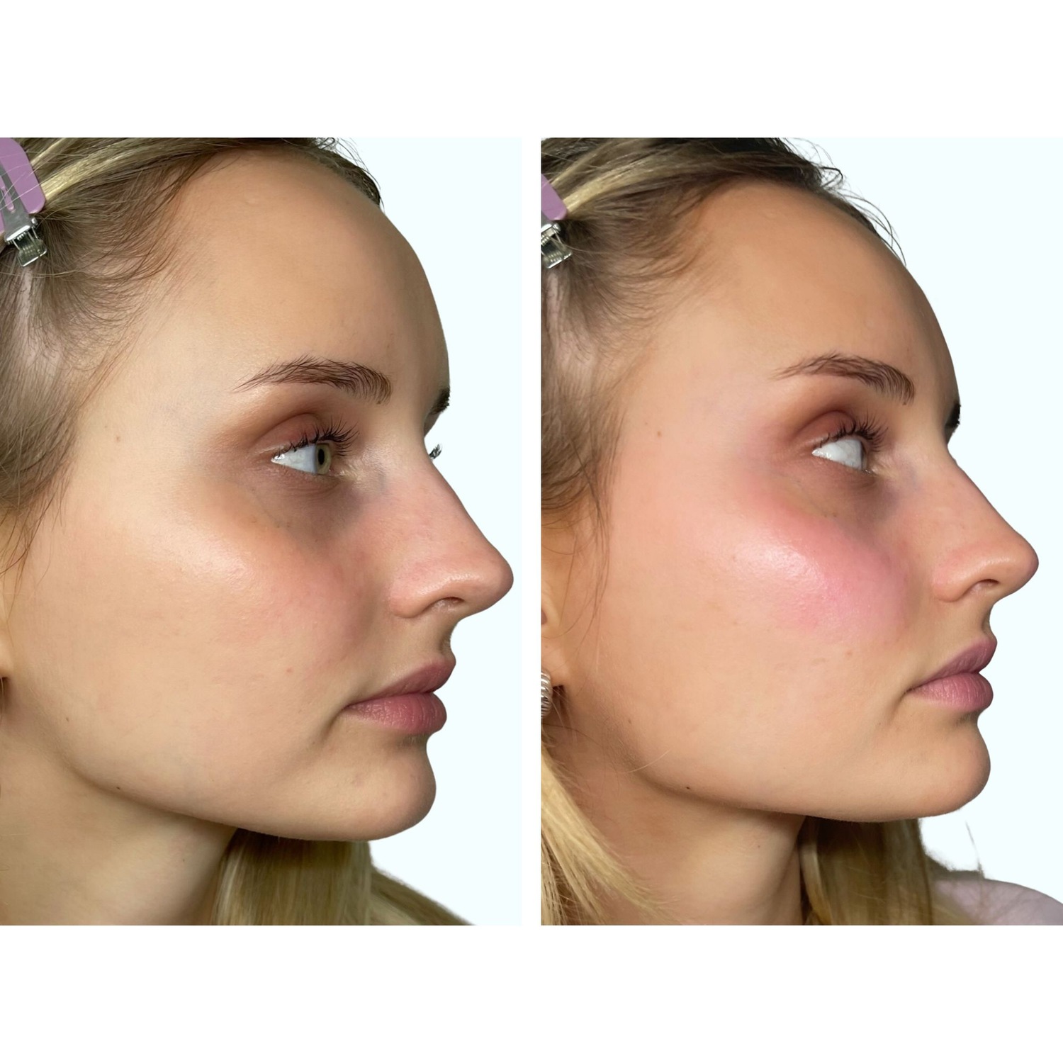 PH-Activated Blush Stick Lip & Cheek