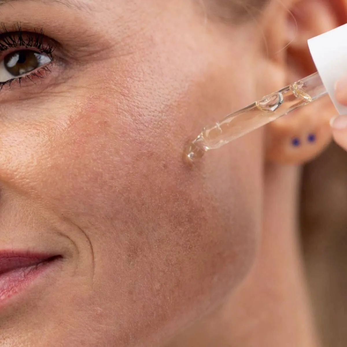 Ido Lab Lumence Forte serum za smanjenje diskoloracije