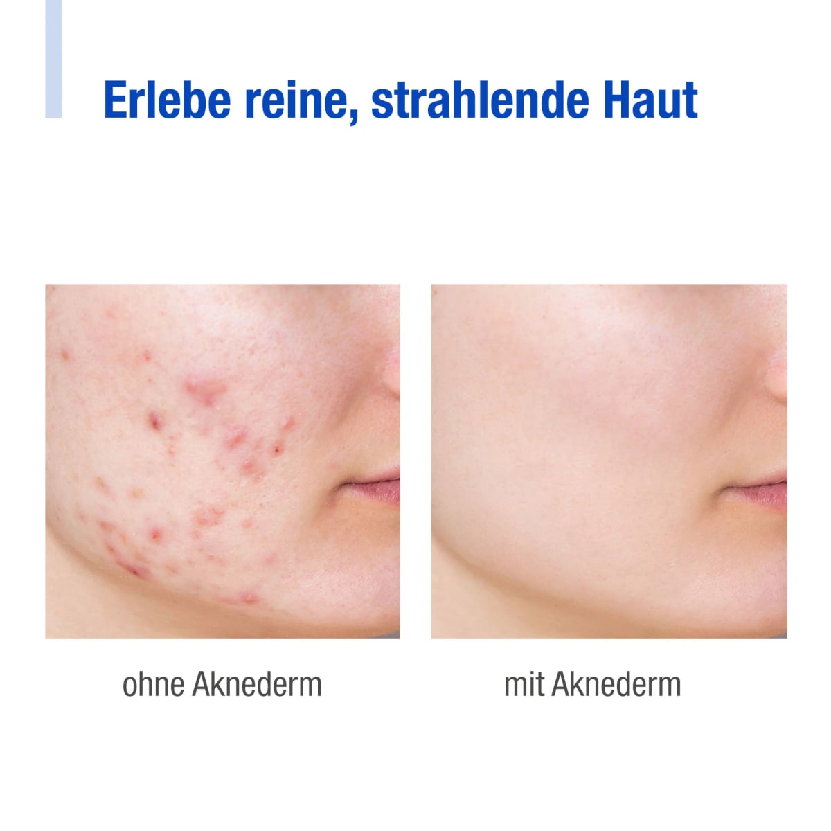 Gesichtscreme intens, 30 g