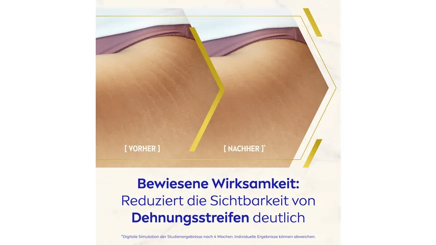 Nivea Luminous Body-Öl-Serum Anti-Dehnungsstreifen 100 ml