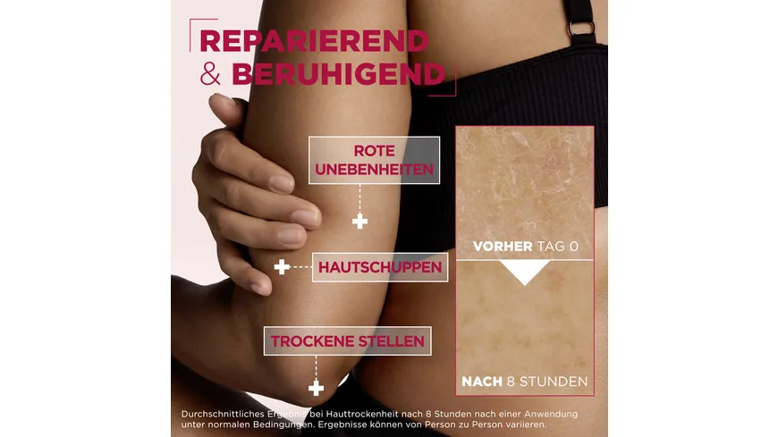 Mixa Urea Cica Repair Hauterneuernde Creme 150 ml