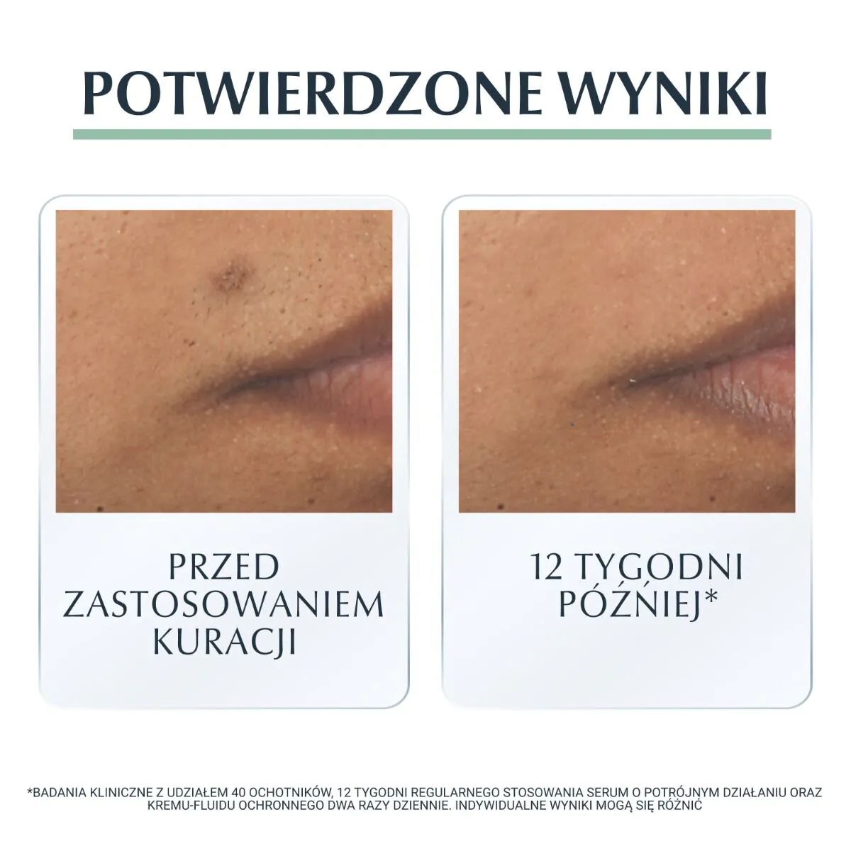 Eucerin Dermopure zaštitna krema-fluid SPF30