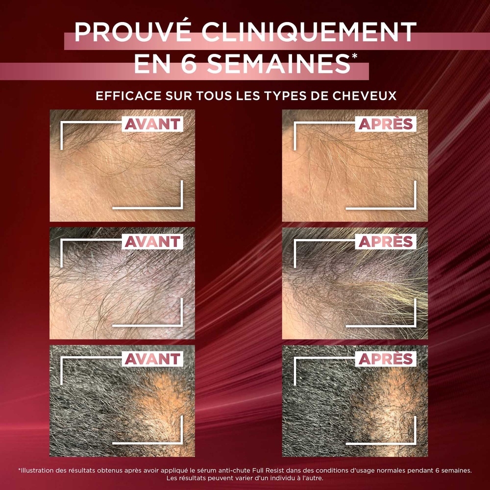 L'Oréal Paris Elseve Full Resist Routine de soins capillaires enrichi enAminexil pour les cheveux fragilisés