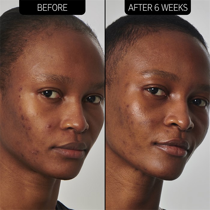 SuperSolutions 20% Niacinamide Serum