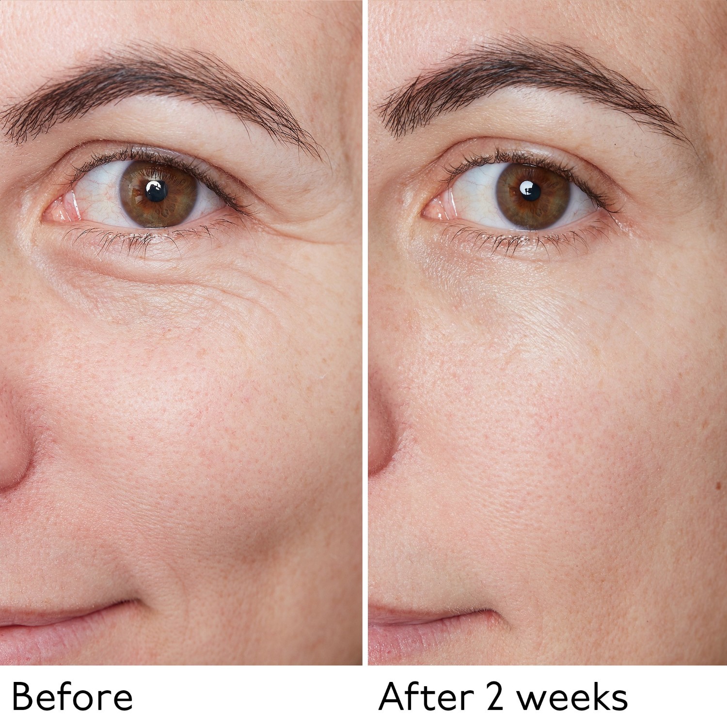 By Terry HIJALURONSKI GLOBALNI SERUM