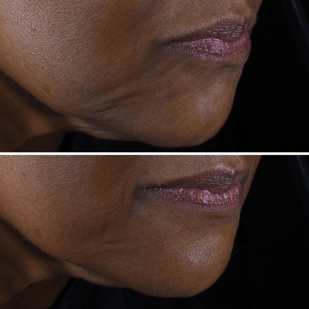 Clinique Smart Clinical Repair™ Crème Liftante Crème Anti-rides Visage + Cou