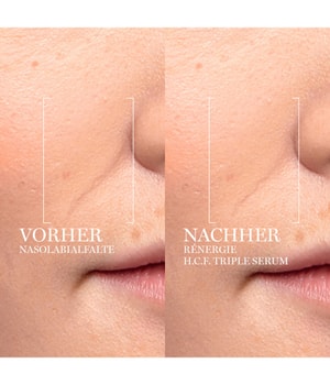 LANCÔME Rénergie H.C.F. Triple Serum Gesichtsserum-50 ml