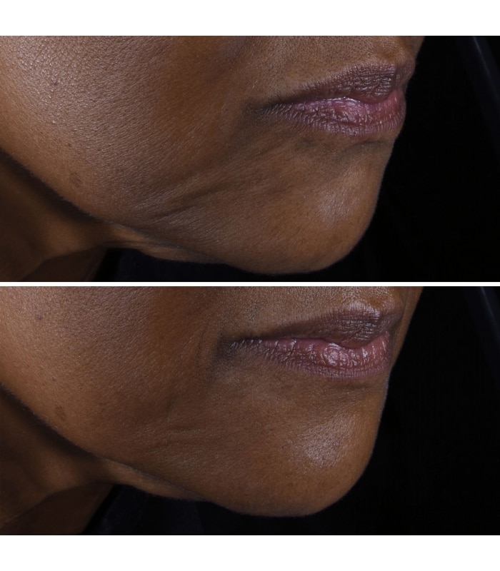 Clinique-SMART CLINICAL-Smart Clinical Repair™ Crème Liftante Visage + Cou