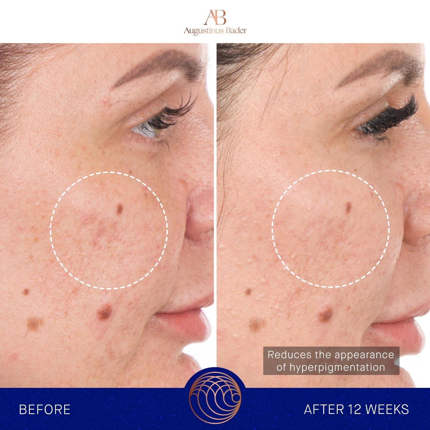 Augustinus Bader retinol serum