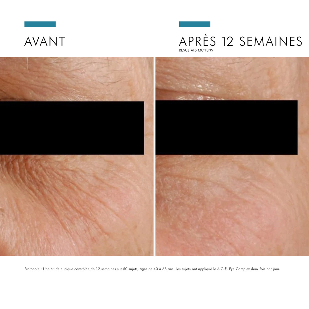 SkinCeuticals A.G.E. Eye Complex Soin anti cernes anti poches pour le contour des yeux - anti-rides et fermeté