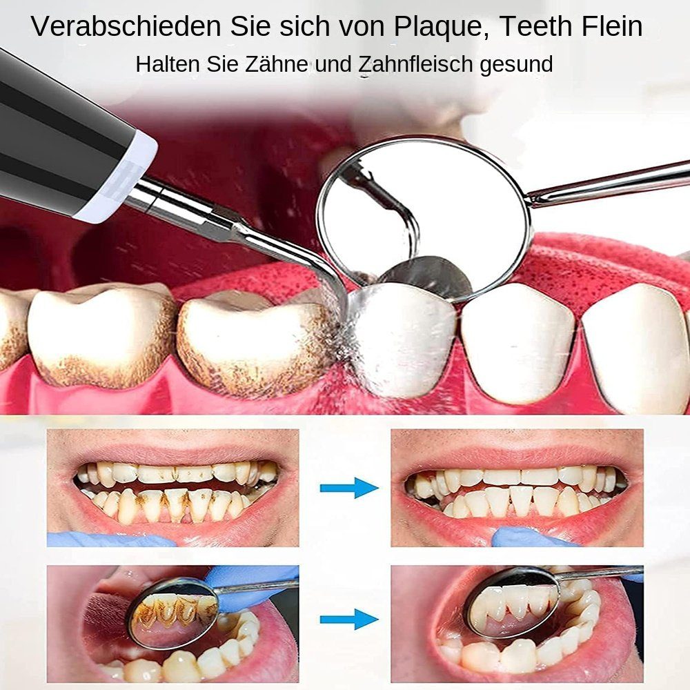 Yoyaxi Zahnpflege-Set Zahnreinigungsset mit 5 Modi und 2 Reinigungsköpfen, 1-tlg., Entfernung von Zahnstein für die Heimpflege der Zähne