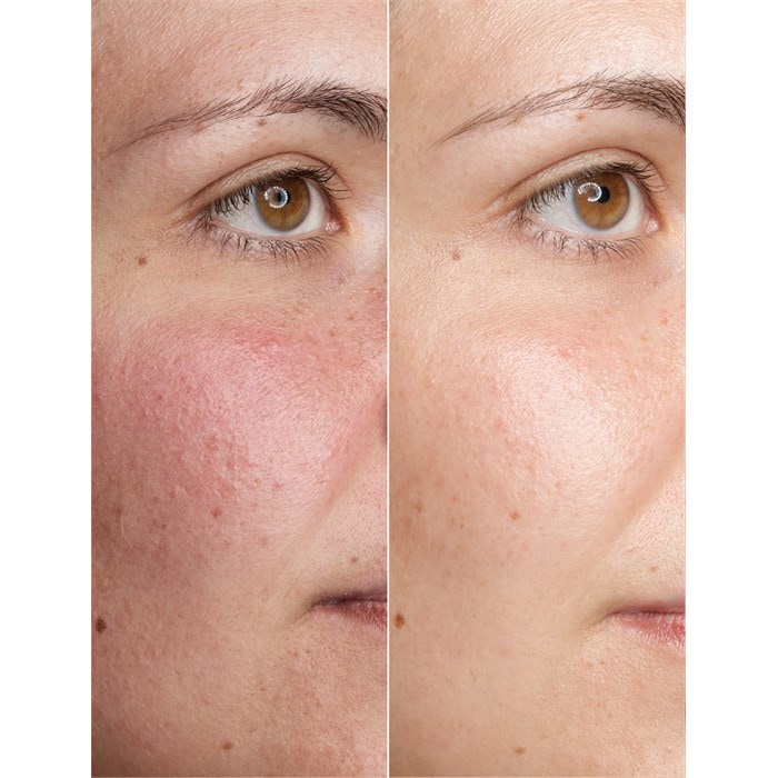 Beta-Glucan Power Serum Ampoules