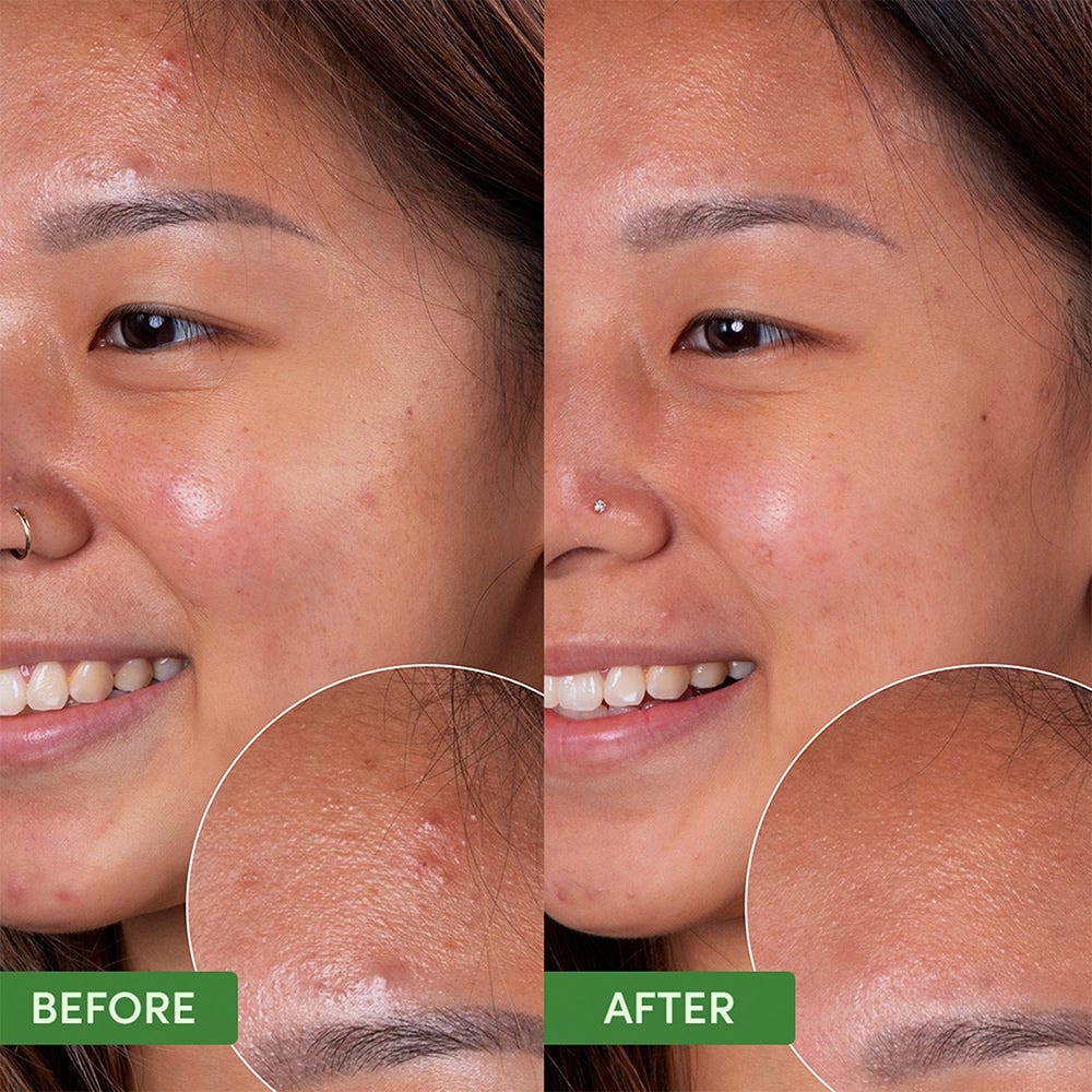 Sand & Sky Oil Control - Clearing Face Mask 100 g