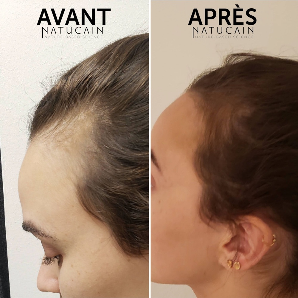 Natucain Natucain Hair Activator Sérum contre la chute de cheveux