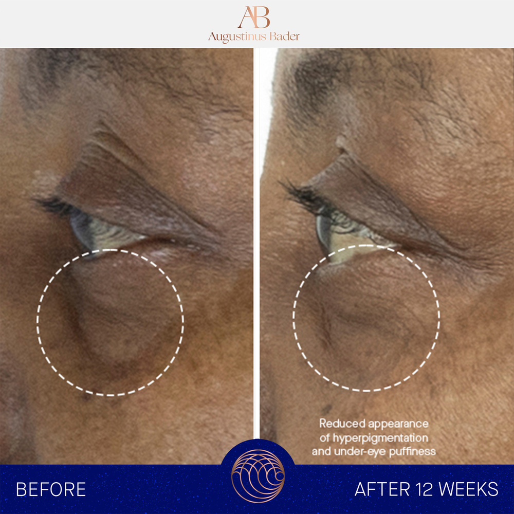 augustinus bader The Eye Cream Nomad Contour des yeux