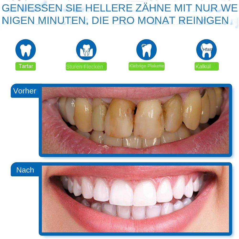 Yoyaxi Zahnpflege-Set Wasserdicht und geräuscharm für Zuhause & Reisen, 1-tlg., 5 Intensitätsstufen, IPX6 Wasserdichtigkeit und praktische LED-Anzeige