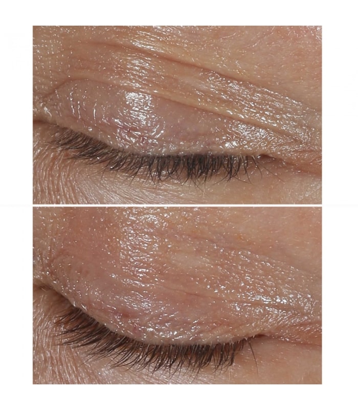 CLINIQUE SMART-Clinique Smart Clinical Repair - Crème Yeux Correction Rides