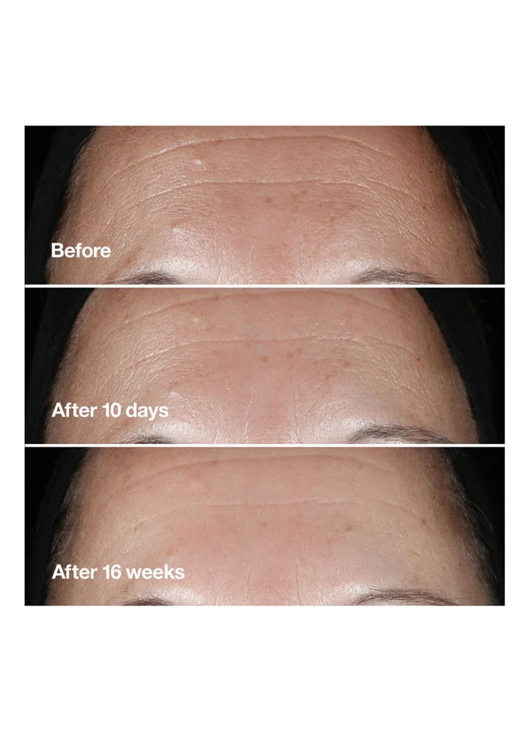 CLINIQUE Smart Clinical Repair™ Ορός Διόρθωσης Ρυτίδων – Ορός Περιορισμένης Έκδοσης