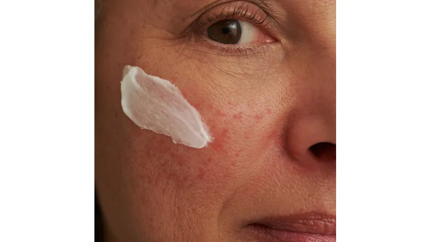DADO SENS SENSACEA Gesichtsemulsion - bei hypersensibler Haut & Couperose 50 ml