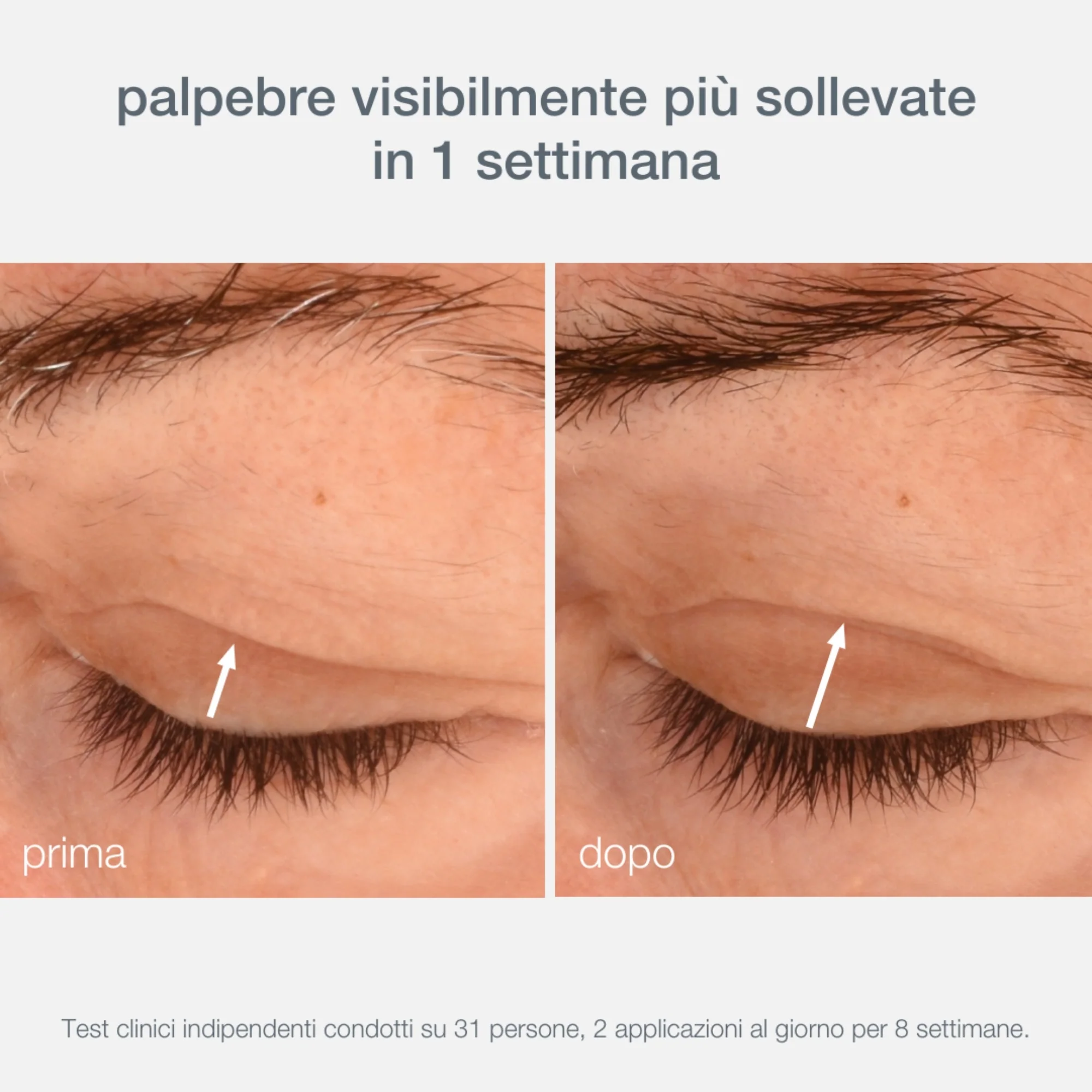 Crema contorno de ojos Phyto Nature Lifting - Crema antiarrugas para el contorno de ojos
