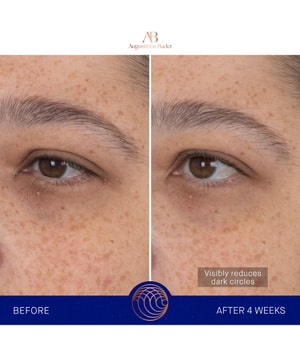 Augustinus Bader The Eye Patches Augenpads 1 Stk