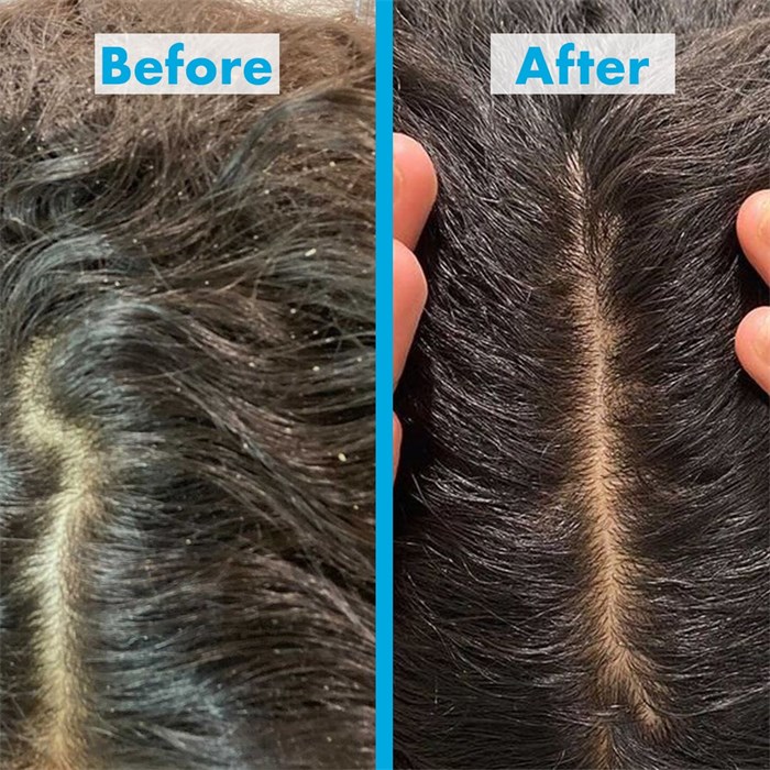 Scalp Reviving Anti-Dandruff Conditioner