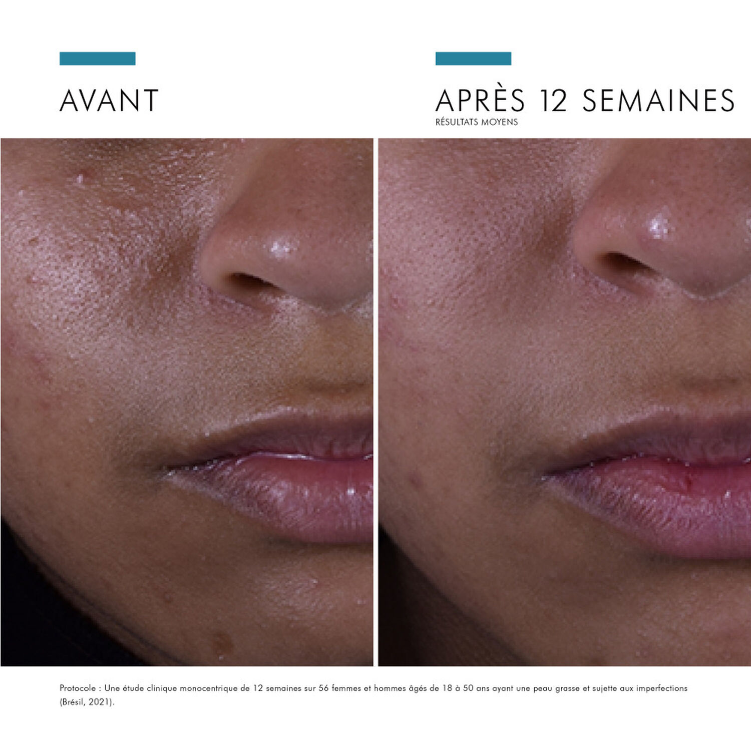 Skinceuticals Silymarin CF Sérum Visage Anti-Imperfection 30 ml