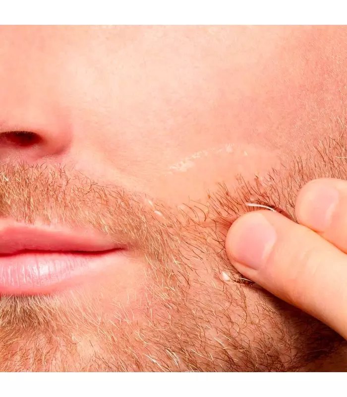 CLARINS MEN Lotion Apaisante Après-Rasage