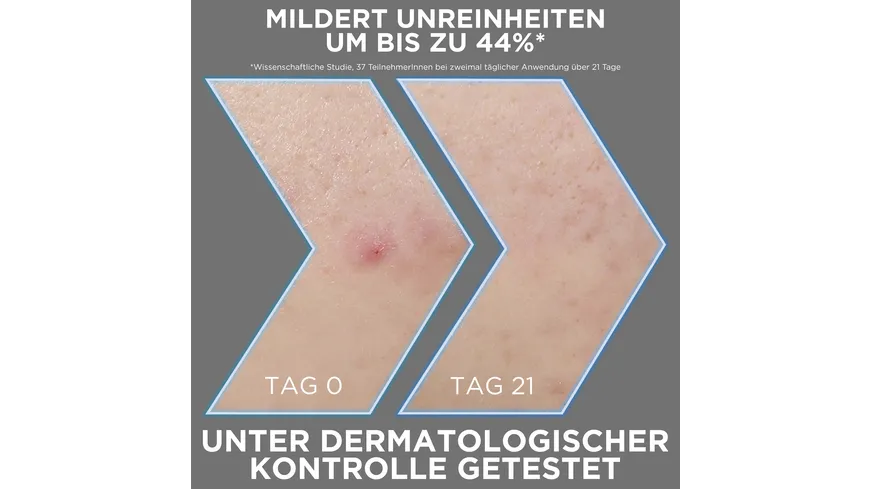 Garnier Hautklar Pure Anti-Akne Serum Blemish Blackout 30 ml