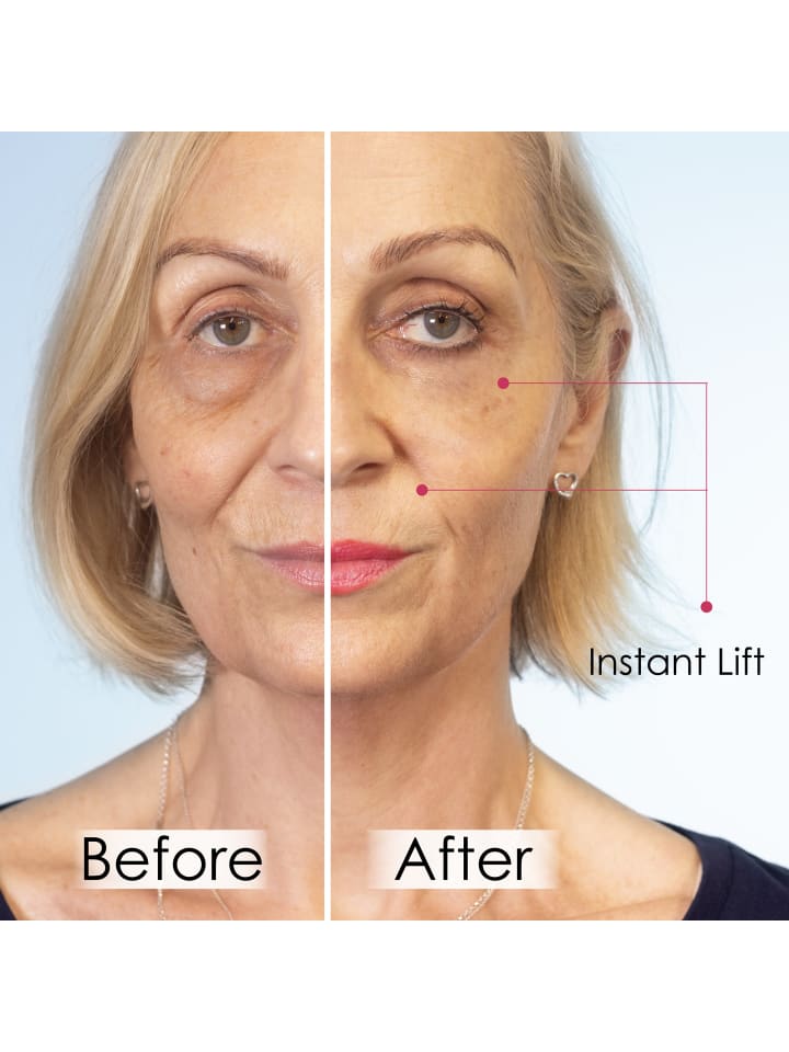 Skinchemists Faltenkiller Instant Lift günstig kaufen onesize