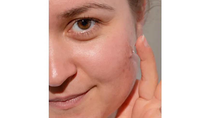 ROSENTAL Akne Serum 30 ml