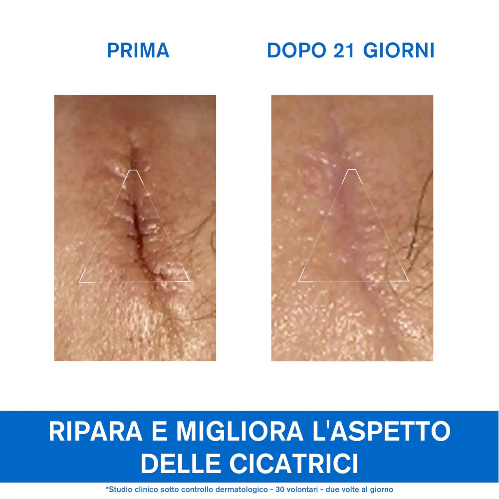 BARIÉDERM-CICA Cream - Repair Treatment, Body Cream